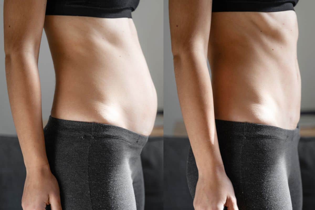 Post-Pregnancy: What Happens to Your Abdominal Muscles After Birth Uxbridge