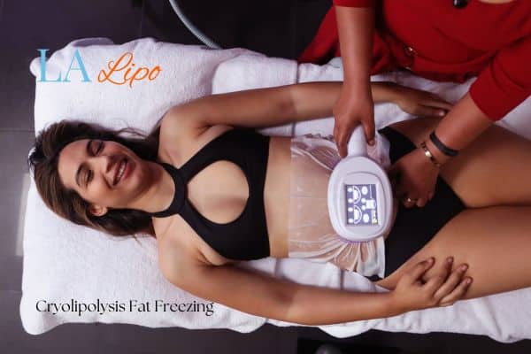 woman getting cryolipolysis Uxbridge