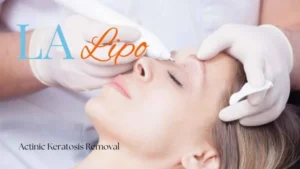 Woman receiving Actinic Keratosis Removal Treatment Uxbridge