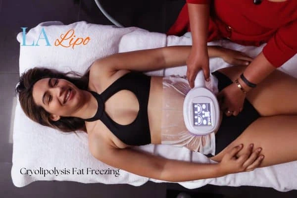 woman getting cryolipolysis Uxbridge