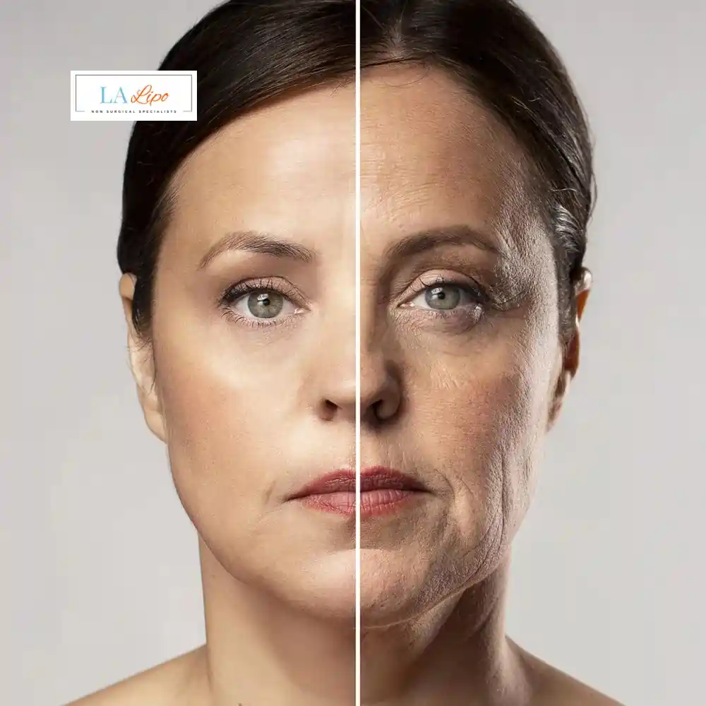 How Can You Tell If Non-Surgical Skin Tightening Is Right for You Uxbridge?