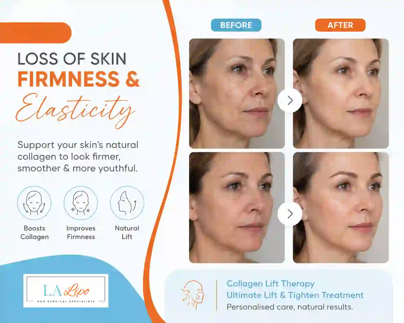 Sign #7: Loss of Skin Firmness and Elasticity Uxbridge