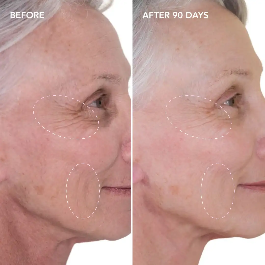 When will you see results Uxbridge